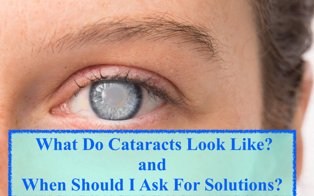 Ask Your Lexington Eye Doctor About Help With Cataracts If You Have These 7 Symptoms
