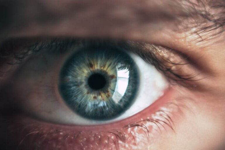 LASIK treatment