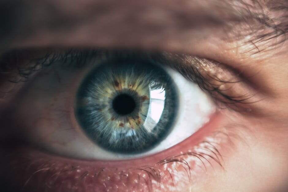 LASIK treatment
