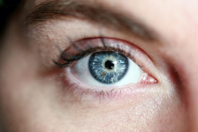 eye doctor lexington ky