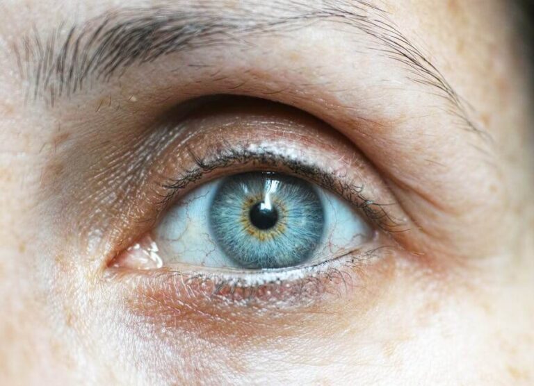 eye health