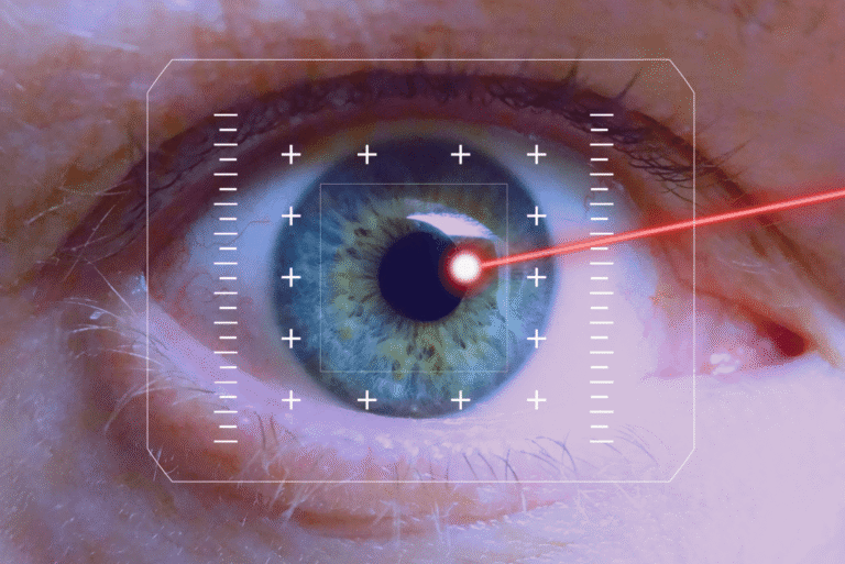 lasik eye surgery recovery