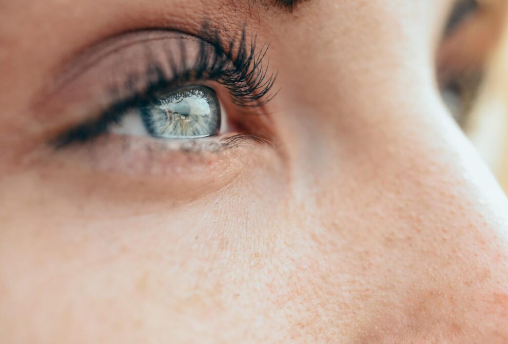 waking up with red eyes